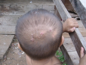 រូបលេខ២